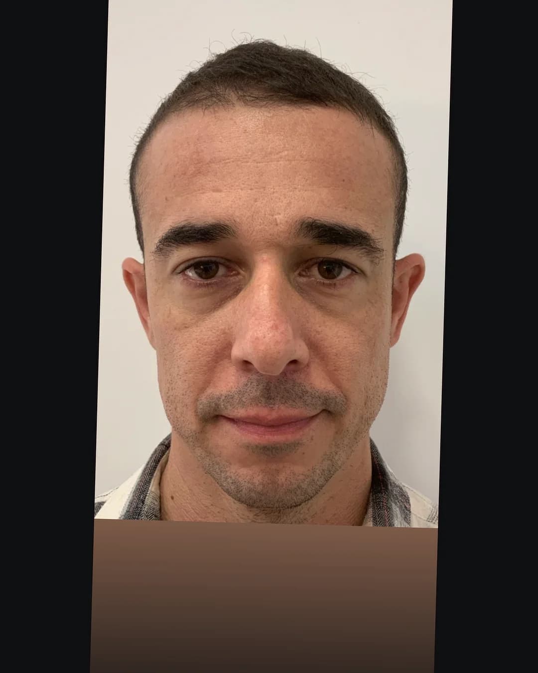 Diagnóstico em vista frontal, paciente M-518